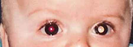 Como uma mãe diagnosticou câncer no filho através de fotografias Como uma mãe diagnosticou câncer no filho através de fotografias